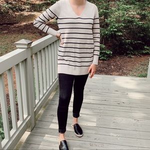 Striped Tunic